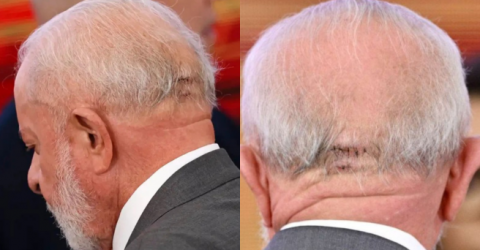 AVC provoca uma morte a cada 6,5 minutos no Brasil, revela estudo - Imagem do artigo original